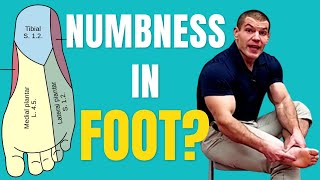 Numbness in Bottom of Foot 5 Causes and Solutions [upl. by Urion980]