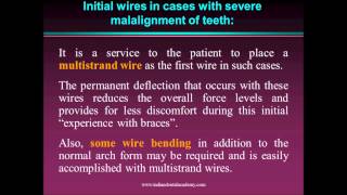 leveling amp aligning in orthodontics  fixed orthodontic courses by Indian dental academy [upl. by Horace885]