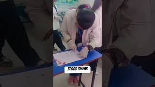 Blood smear preparation youtube shorts dream subscribe ytshorts [upl. by Deron]