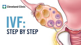 How Does In Vitro Fertilization IVF Work A StepbyStep Explanation [upl. by Asilat336]