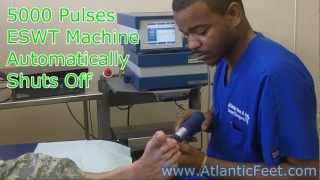 Plantar Fasciitis Treatment with ESWT Video [upl. by Navy]