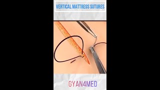 Vertical Mattress Suture  Best Suture Techniques [upl. by Yeca]