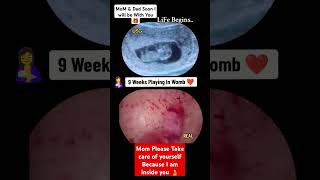 9 Weeks Baby Growing Inside Womb Pregnancy Ultrasound baby pregnancy babyboy babygirl boy [upl. by Jourdan]