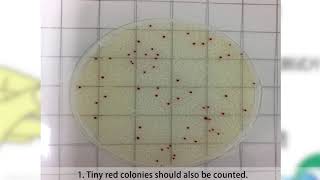 Test Procedure of Meizheng  MicroFast® Aerobic Count Plate [upl. by Baudin]