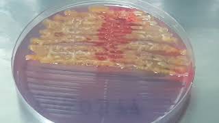 Serratia fonticola on CLED Agar Uropathogen [upl. by Havard]