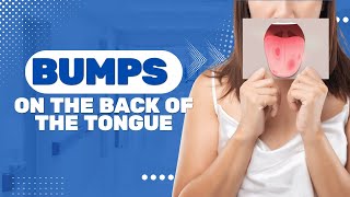 Bumps On The Back Of The Tongue 5 Symptoms And Rare Causes [upl. by Ayidan]