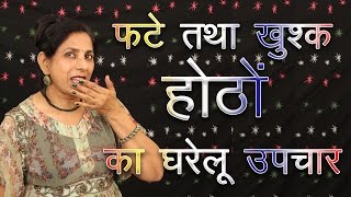 Home remedies for chapped Lips  Beauty Videos in Hindi  Beauty Channel  Beauty Blogger Skin Care [upl. by Ehcar]