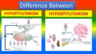 Difference Between Hypopituitarism and Hyperpituitarism [upl. by Secunda]