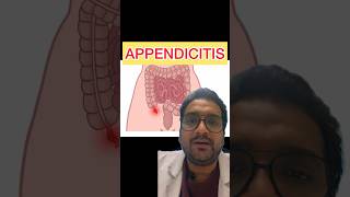 Acute Appendicitis Symptoms and treatment appendicitis appendix [upl. by Uliram]