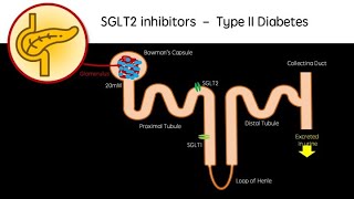 SGLT2 Inhibitors Dapagliflozin empagliflozin  Type 2 Diabetes revision video [upl. by Sulienroc]