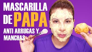 ELIMINA ARRUGAS ACLARA MANCHAS DE LA PIEL CON LA MASCARILLA DE PAPA [upl. by Mathilde]