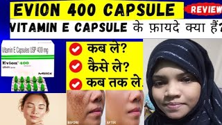 vitamin e capsules evion 400 capsules for face pigmentation pimples ko kese thik karta hai [upl. by Roux]