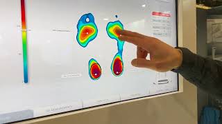 Aetrex 3d foot scanner video [upl. by Beckett]