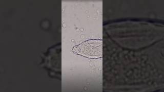 schistosoma haematobium in urine slide test viral shorts [upl. by Burkhardt]