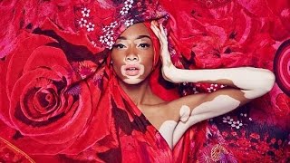 Chantelle Winnie Harlow  Desigual Fall 2014 Polka Dots Campaign [upl. by Sabino829]