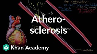 Atherosclerosis  Circulatory System and Disease  NCLEXRN  Khan Academy [upl. by Niarb733]