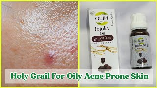 Jojoba Oil For Oily Acne Prone Skin How I Use Jojoba Oil [upl. by Ahsienat]