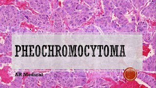 Pheochromocytoma Pathophysiology Symptoms Treatment [upl. by Enovahs]