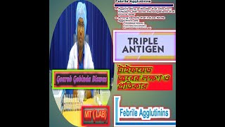 Febrile Antigens  Triple Antigens test procedure Febrile antigen test in Bangla [upl. by Janenna597]