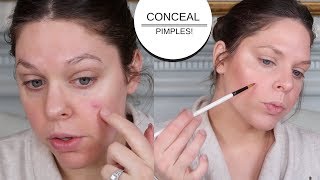 How To Conceal A Pimple Acne Coverage Makeup Tutorial [upl. by Bannister890]