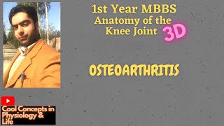 3D Anatomy Knee joint  Clinical Scenario  OSTEOARTHRITIS 1st year MBBS [upl. by Edna]