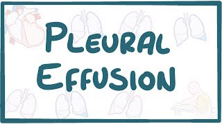 Pleural Effusion  causes symptoms diagnosis treatment pathology [upl. by Jerad]