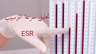 ESR تحليل معدل ترسيب الدم [upl. by Marnia702]