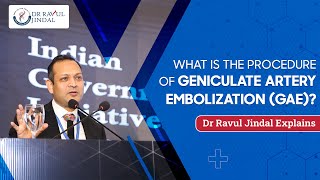 What is the Procedure of Geniculate Artery Embolization GAE  Dr Ravul Jindal Explains [upl. by Donatelli]