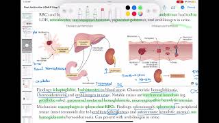 Extravascular hemolysis haematology 44 First Aid USMLE Step 1 in UrduHindi [upl. by Peregrine]