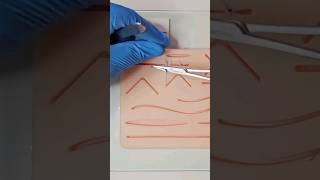 Precision  speed  perfection sutures suturetutorial woundclsoure meded surgicalskills [upl. by Aramit]