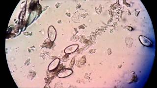 Huevos de Enterobius vermicularis con larva viable [upl. by Nnalorac]