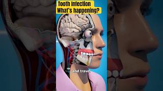 Untreated Tooth INFECTION  What’s happening to your body [upl. by Lacombe]