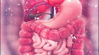 Intestinal obstruction part 1 [upl. by Okun371]