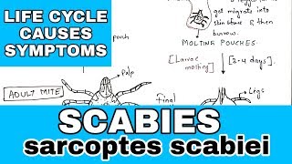 Scabies  sarcoptes scabiei  Life cycle causes symptoms  Bio science [upl. by Nichani248]