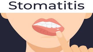 stomatitiscauses of stomatitissymptoms of stomatitisshort [upl. by Favian339]