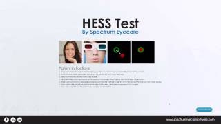 Clinical Tutorial  HESS EOM Test [upl. by Clarke]