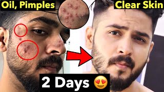 10 Pimple Mistakes  How to Remove Pimples From Face  Remove Acne Naturally [upl. by Paola220]