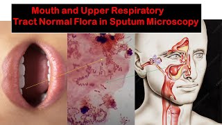 Mouth and Upper Respiratory Tract Normal Flora in Sputum Microscopy [upl. by Aicak]