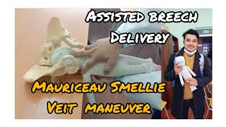 Mauriceau Smellie veit maneuverAssisted breech delivery  aquiqur rahman college mbbs mbbsabroad [upl. by Reidar]