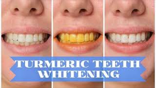 Turmeric Helps To Treat Teeth Pain And Infections How To Use [upl. by Eceinert]