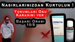 Nasırı Verrutol Yöntemiyle Geçirme \u00100 Çözüm [upl. by Yme322]