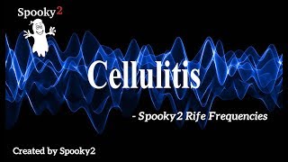 Cellulitis  Spooky2 Rife Frequencies [upl. by Ocsicnarf932]