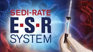 SediRate ESR System from Globe Scientific [upl. by Derfiniw220]