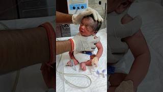 Baby massage therapy 🥹 newborn baby cute hospital shorts short yt nicu [upl. by Venator368]