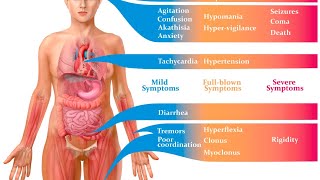 Serotonin Syndrome CyproheptadineSymptoms of Serotonin syndromeSerotonin syndrome in Urdu [upl. by Homer]