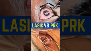 LASIK VS PRK [upl. by Dier]