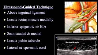 Pain Medicine  Ilioinguinal Nerve Iliohypogastric Nerve Inguinal Canal TAP [upl. by Nuarb]