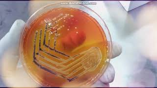 Xylose Lysine Deoxycholate agar  XLD  Selective medium for Salmonella and Shigella [upl. by Ayala]