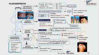 1 MAPA MENTAL REUMATOLOGÍA MONOARTRITIS [upl. by Chantal81]