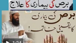 Burs برص Beemari k roohani ilaj I Wazifa vitiligo I Vitiligo disease I safed daag k ilaj I smr55 [upl. by Ermengarde149]